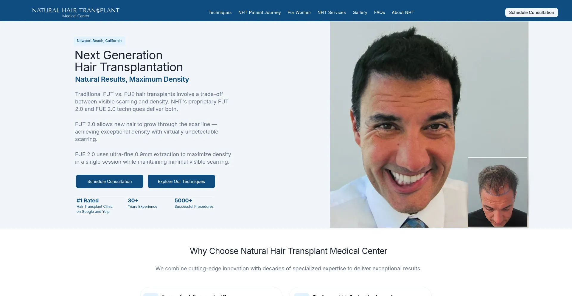 Hairtransplant.com